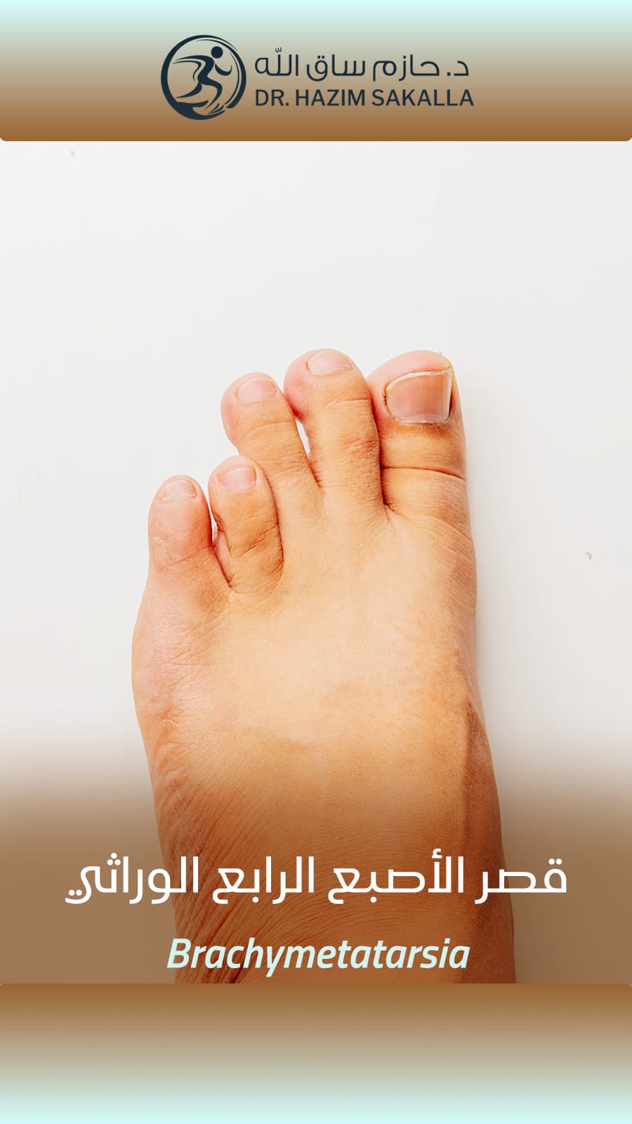 جراحة ترميمية - نتائج تجميلية ووظيفية ممتازة | د. حازم ساق الله الرياض