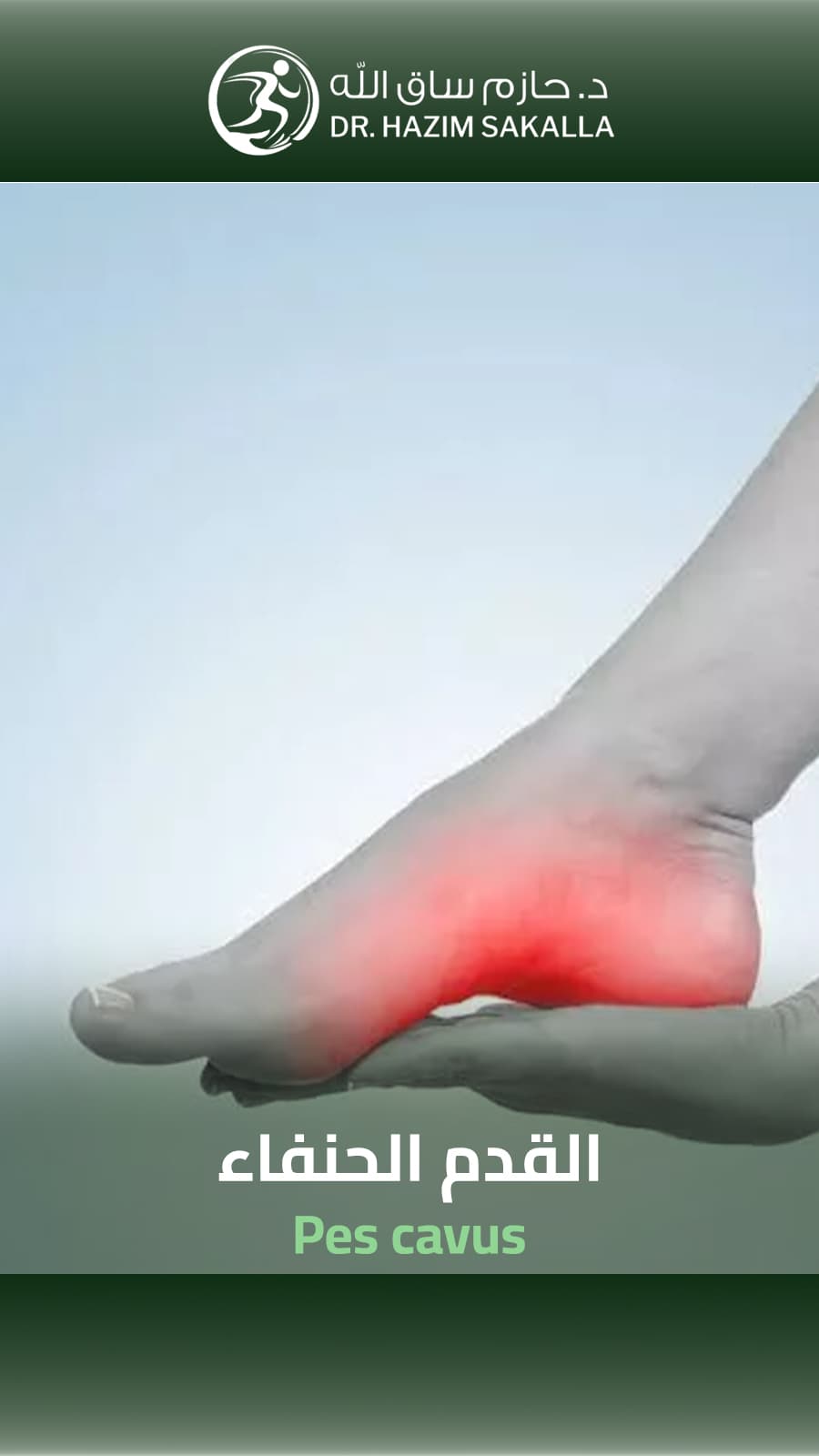 إصابة رياضية إصابة رياضية - عودة كاملة للنشاط الرياضي | د. حازم ساق الله الرياض